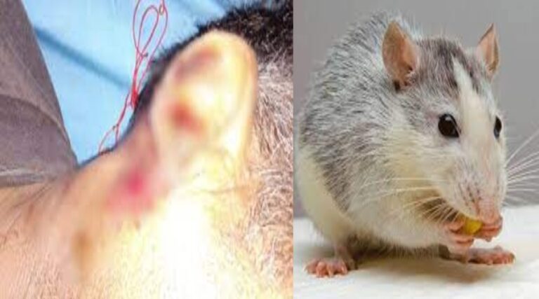 rait-bite.jpg
